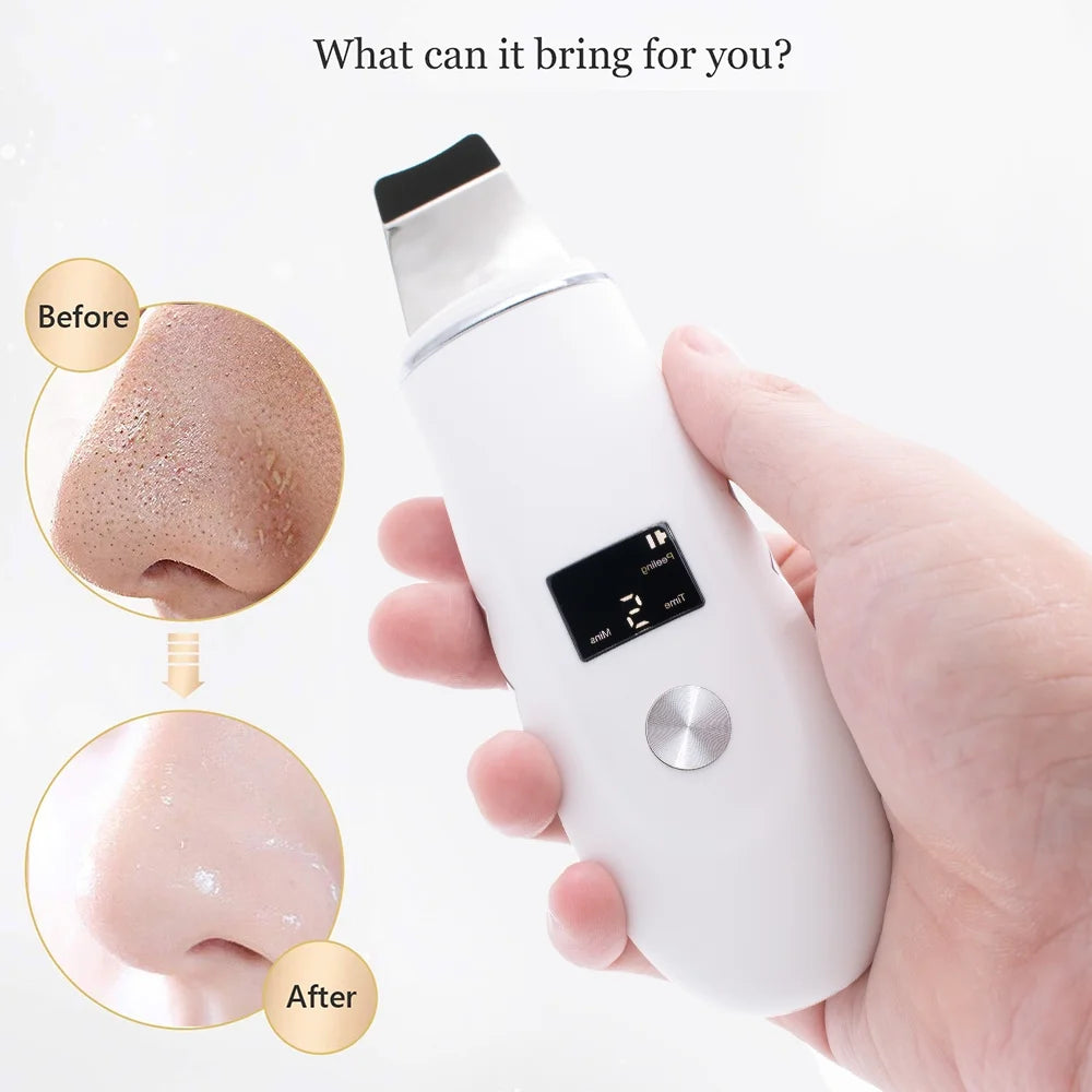 Gleamara™ Ultrasonic Skin Scrubber – 4-in-1 Deep Cleansing Tool